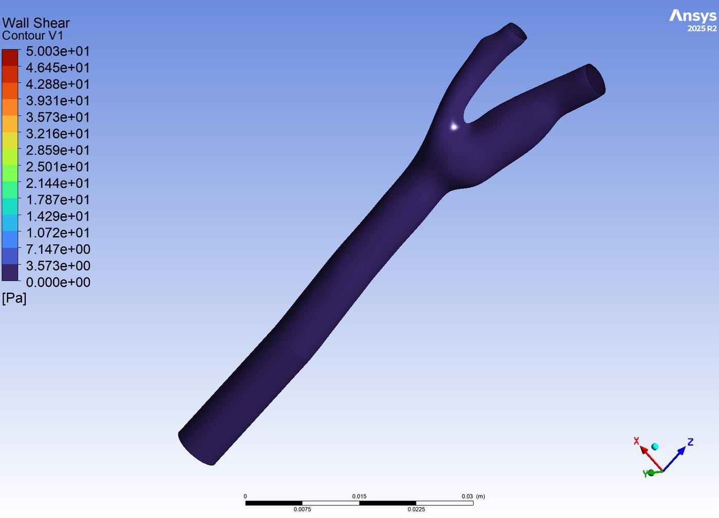 Wall shear stress contour on the carotid walls at end diastole