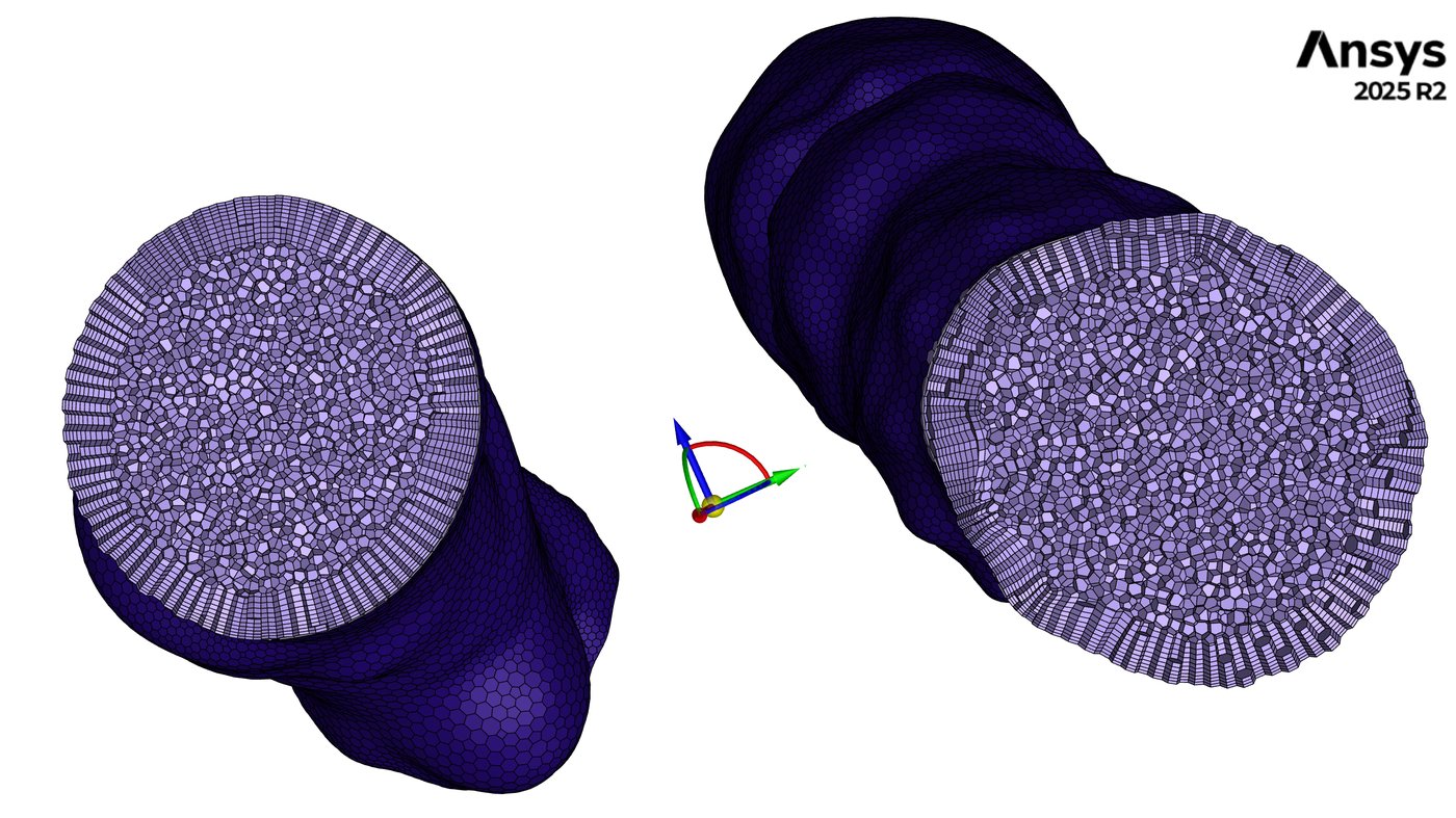 Stented geometry, internal cut view