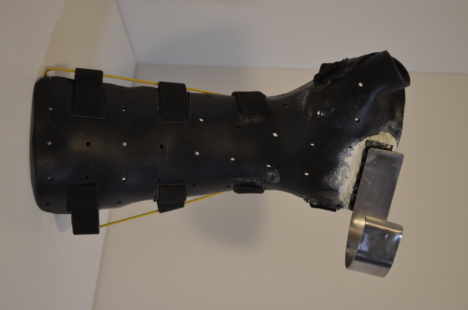 Steel J-hook attachment mounted on the splint